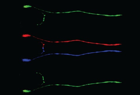 Left/Right Neuronal Asymmetry