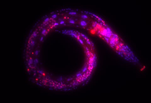 Neuronal Plasticity & Maintenance